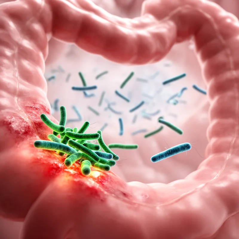 enterobacteria