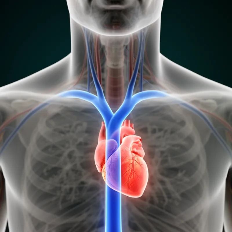 brachiocephalic vein