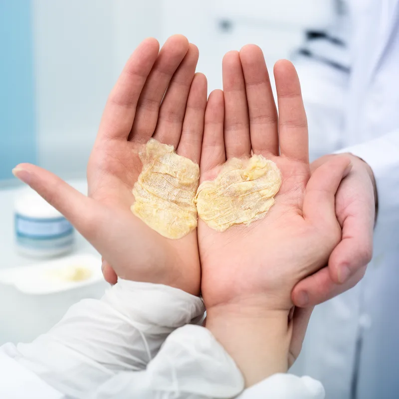 keratodermia