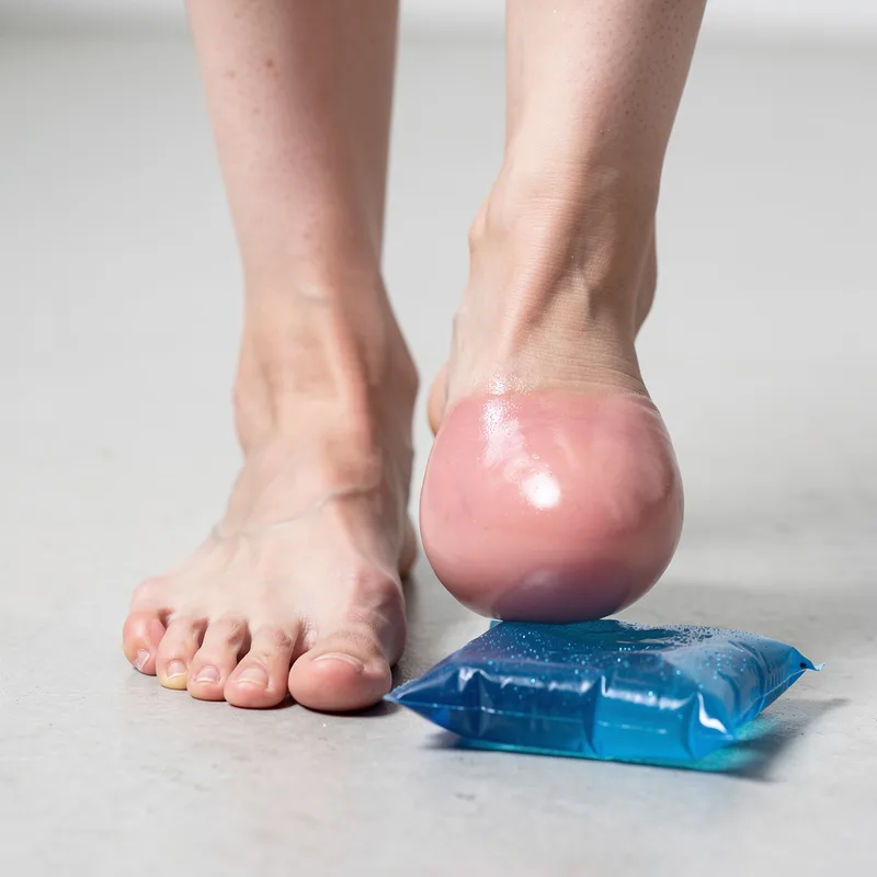 swollen