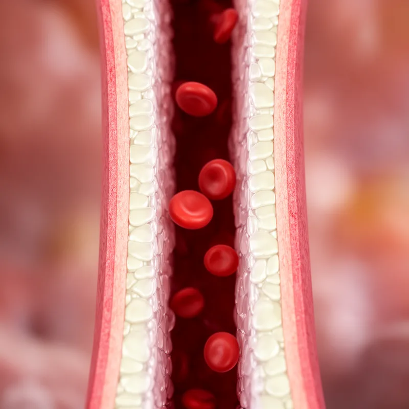 endothelium