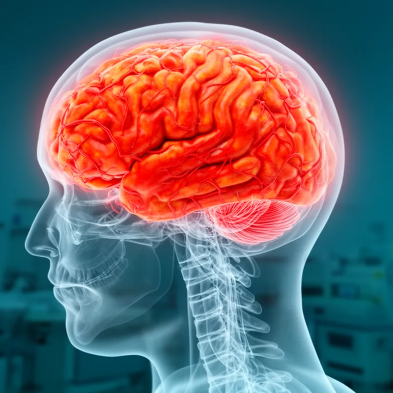 panencephalitis