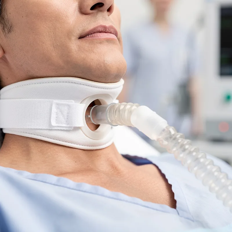 tracheostomy