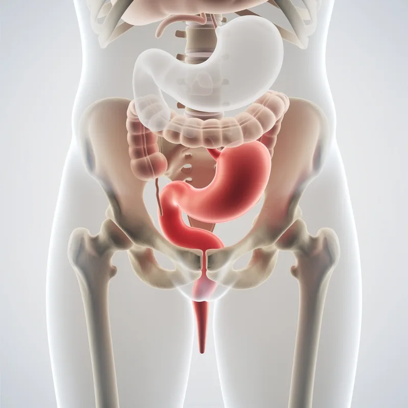 prolapse