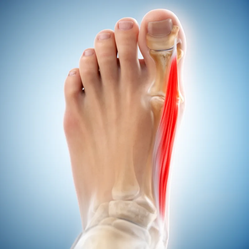 musculus abductor digiti minimi pedis
