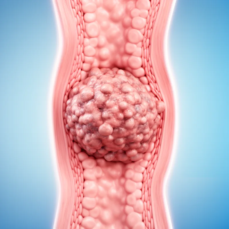tumor