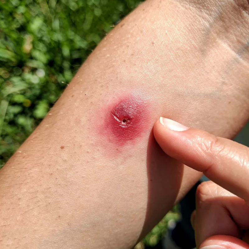 bite
