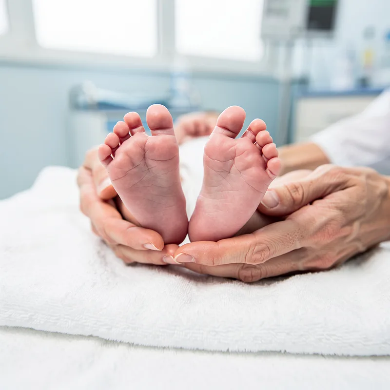 clubfoot