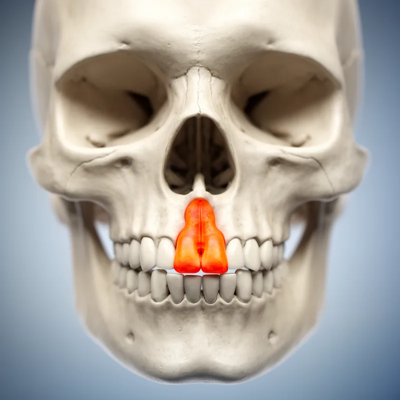 intermaxillary