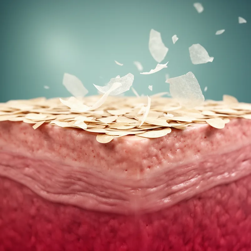 stratum corneum