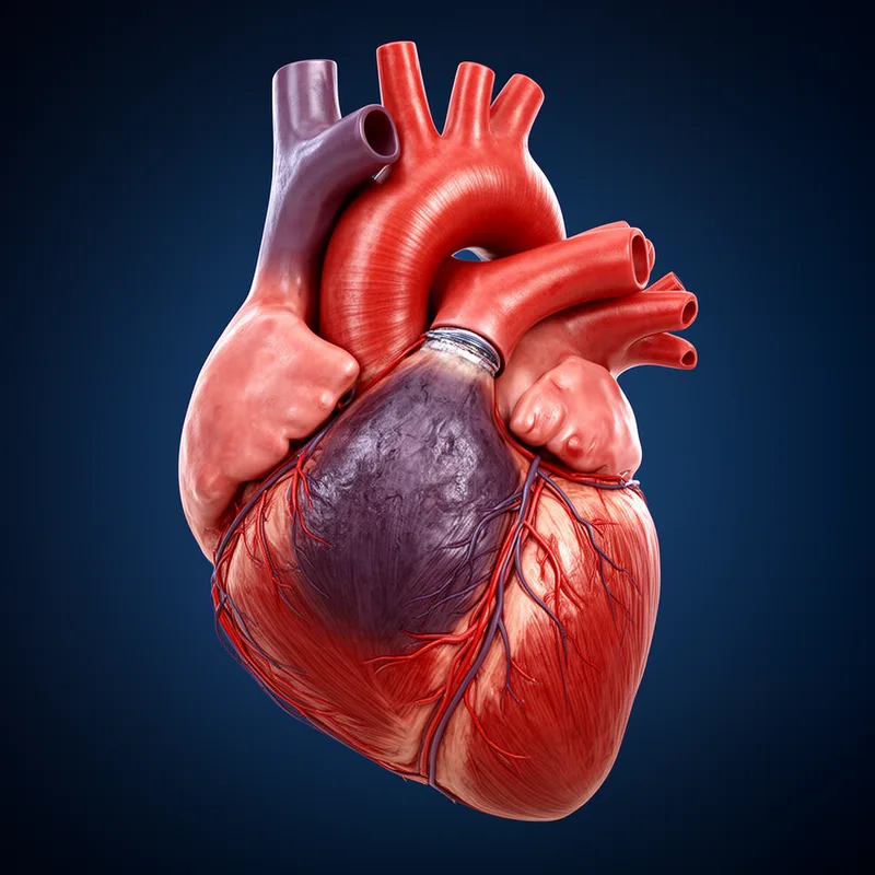 myocardial infarction