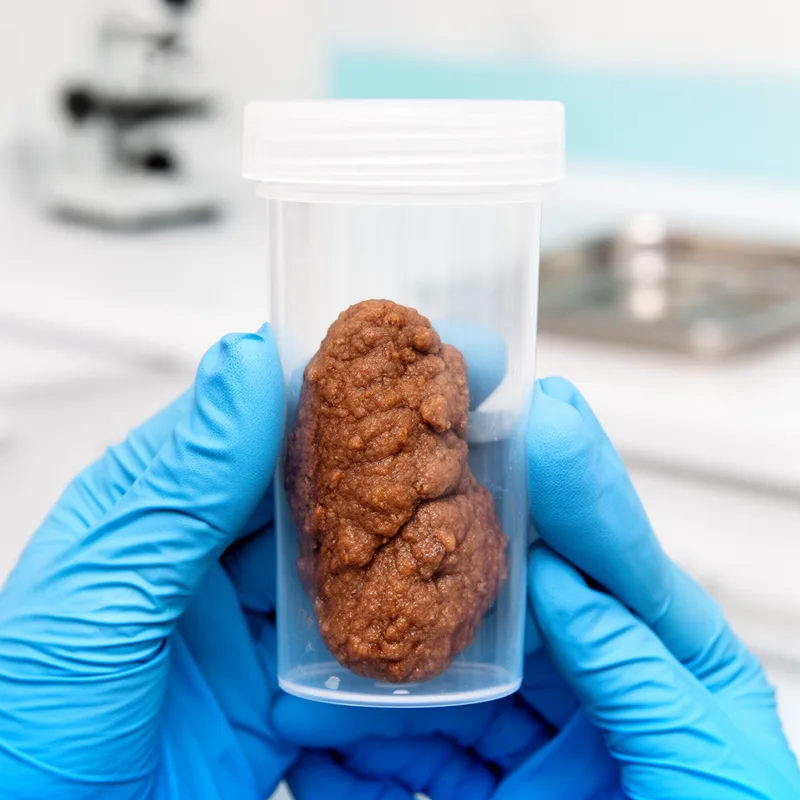 feces
