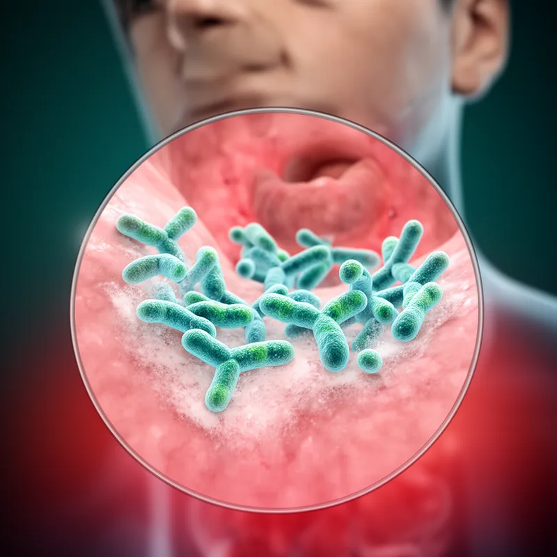 Corynebacterium diphtheriae
