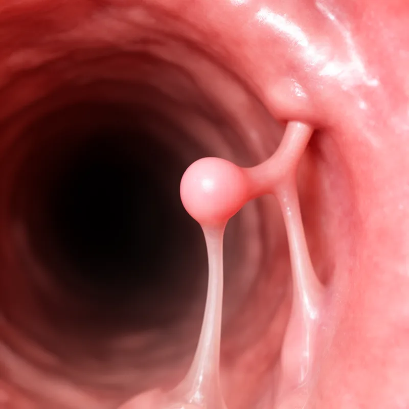 peduncle