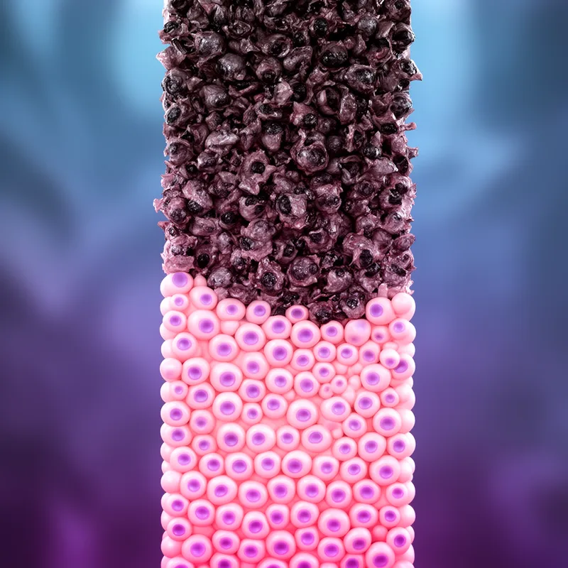 cancerization