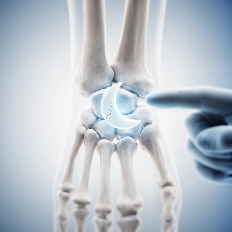 semilunar bone