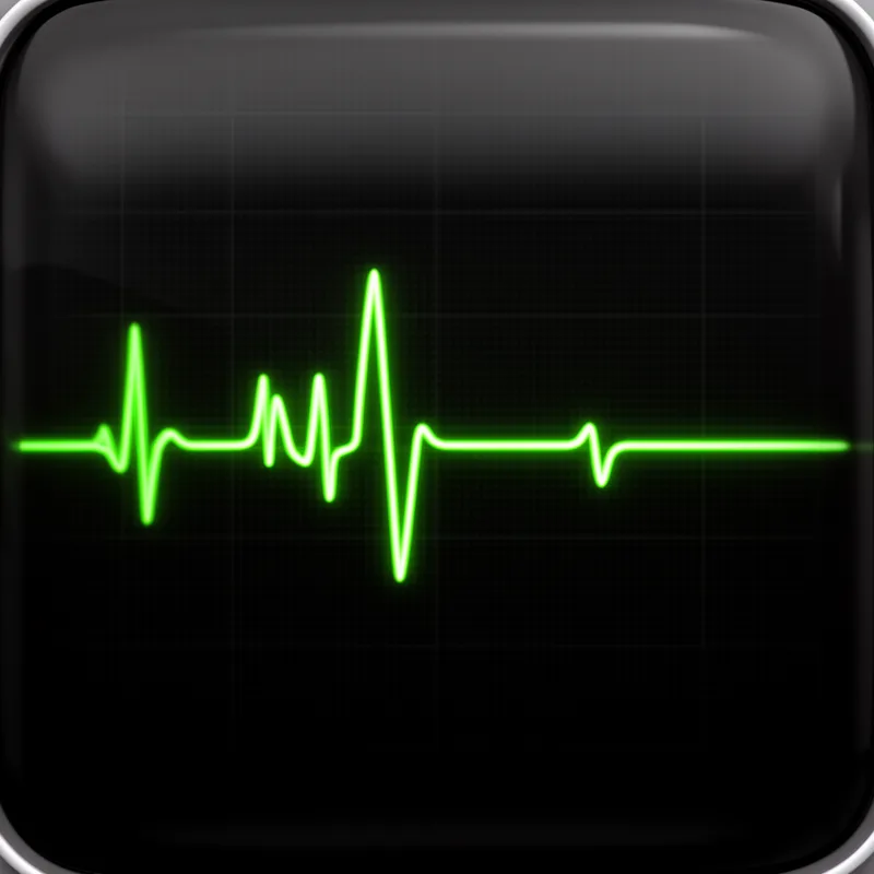 arrhythmia