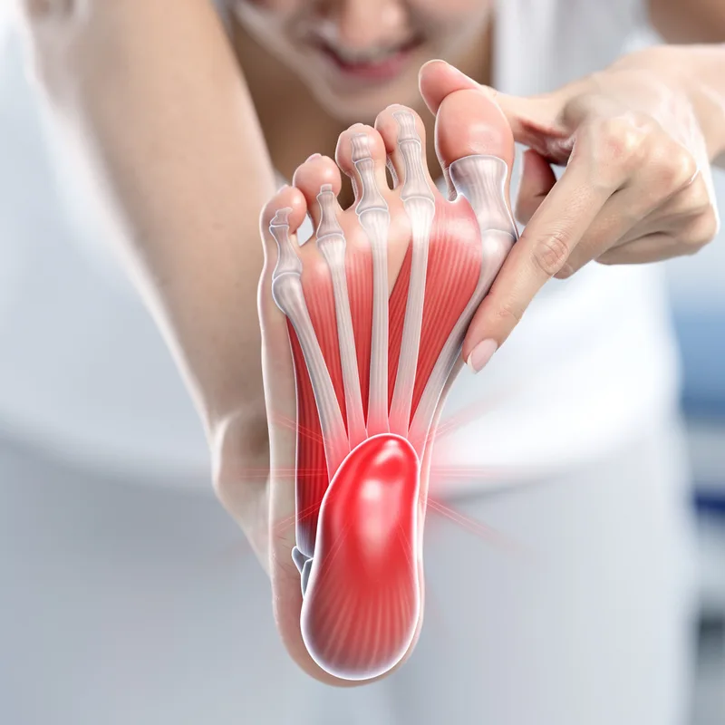 fasciitis