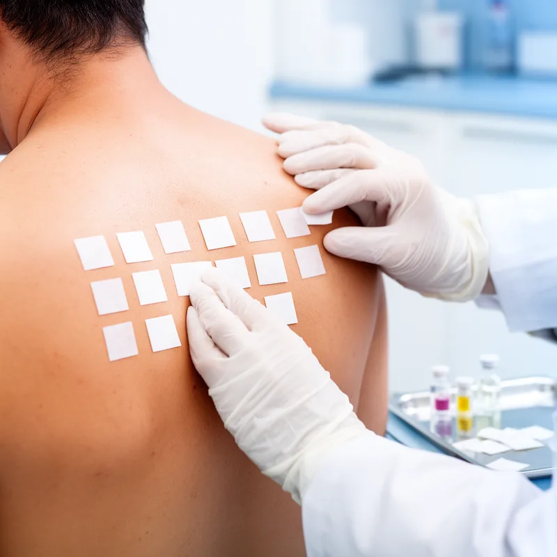 patch test
