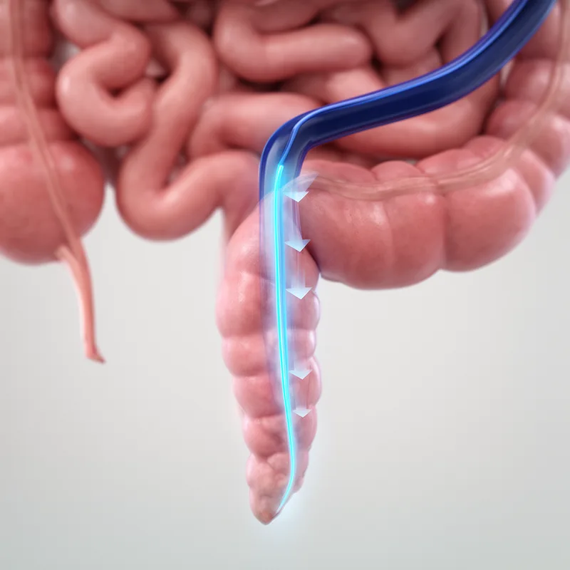 appendicular vein