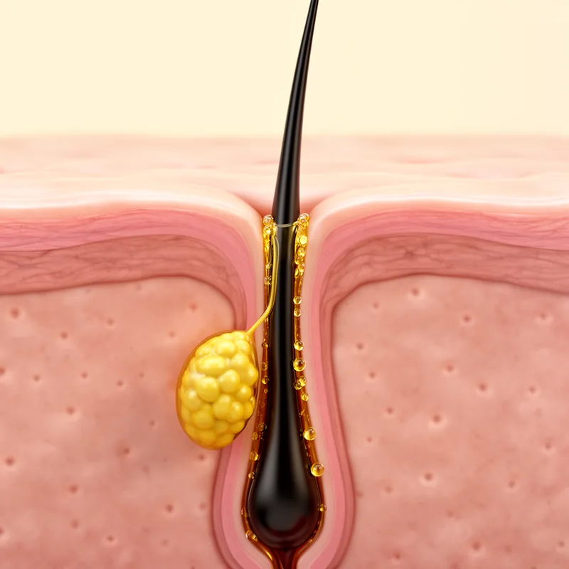sebaceous follicle