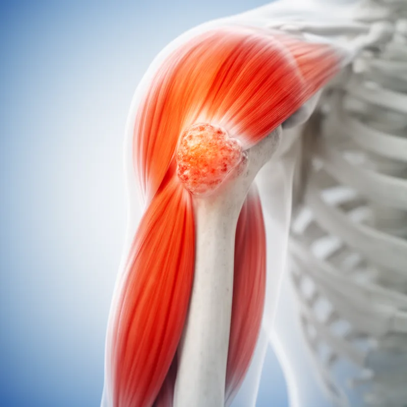 deltoid eminence