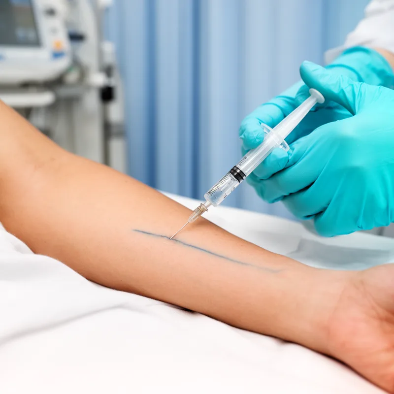intravenous injection