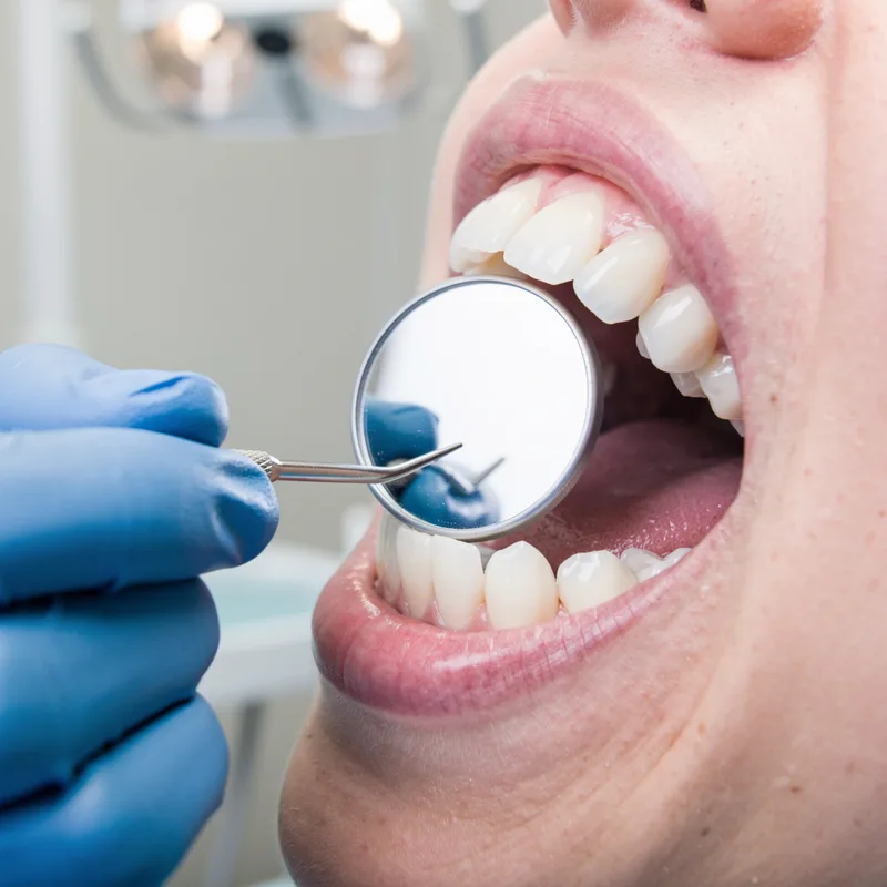 dental